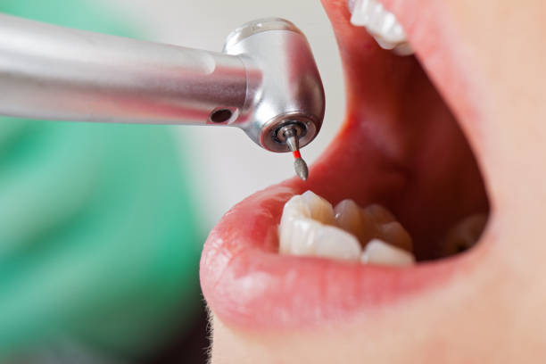 Best Emergency Treatment for Oral Infections in Corning, AR